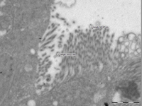 Электронная микрофотография препарата, изготовленного из тканей Dytiscus dimidiatus, larva L3